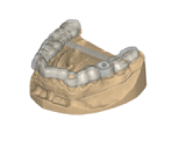 exoplan (TruSmile Module Included)