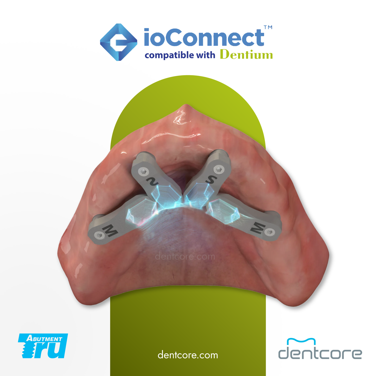 TruAbutment ioConnect Dentium MUA Compatible Scanbody