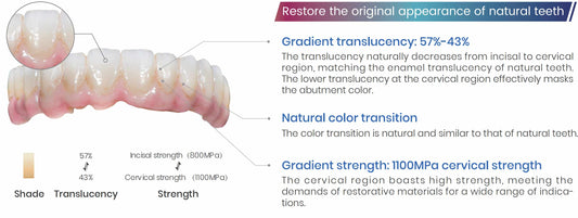 Monolithic zirconia vs lithium disilicate: when to use which (2026)