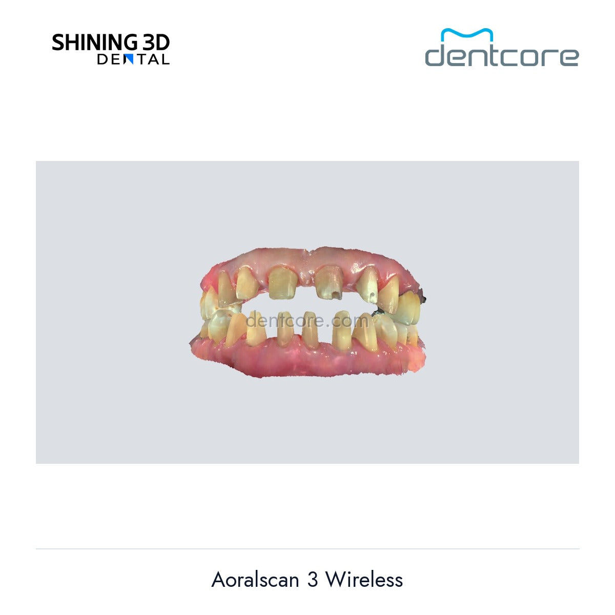 [DENTCORE-OFFICIAL] Aoralscan 3 Wireless official product image 3