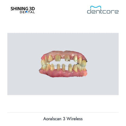[DENTCORE-OFFICIAL] Aoralscan 3 Wireless official product image 3