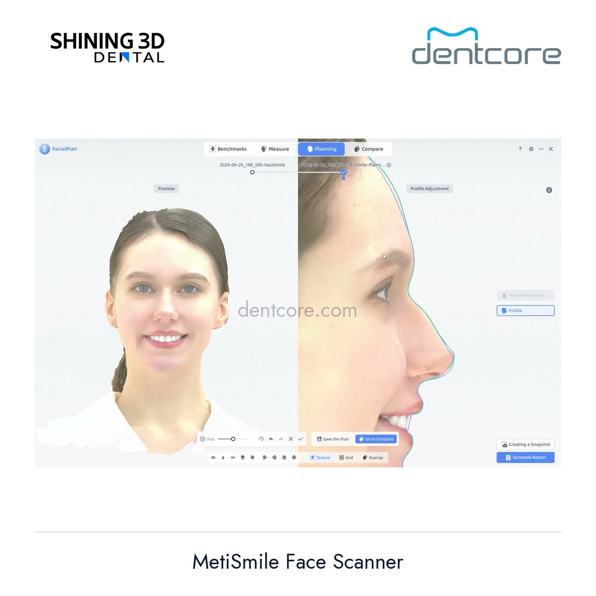 [DENTCORE-OFFICIAL] MetiSmile Face Scanner official product image 3
