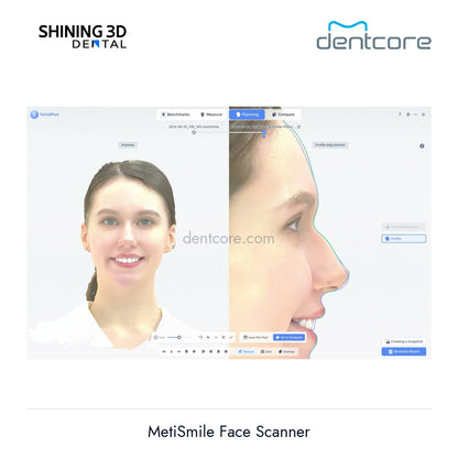 [DENTCORE-OFFICIAL] MetiSmile Face Scanner official product image 3