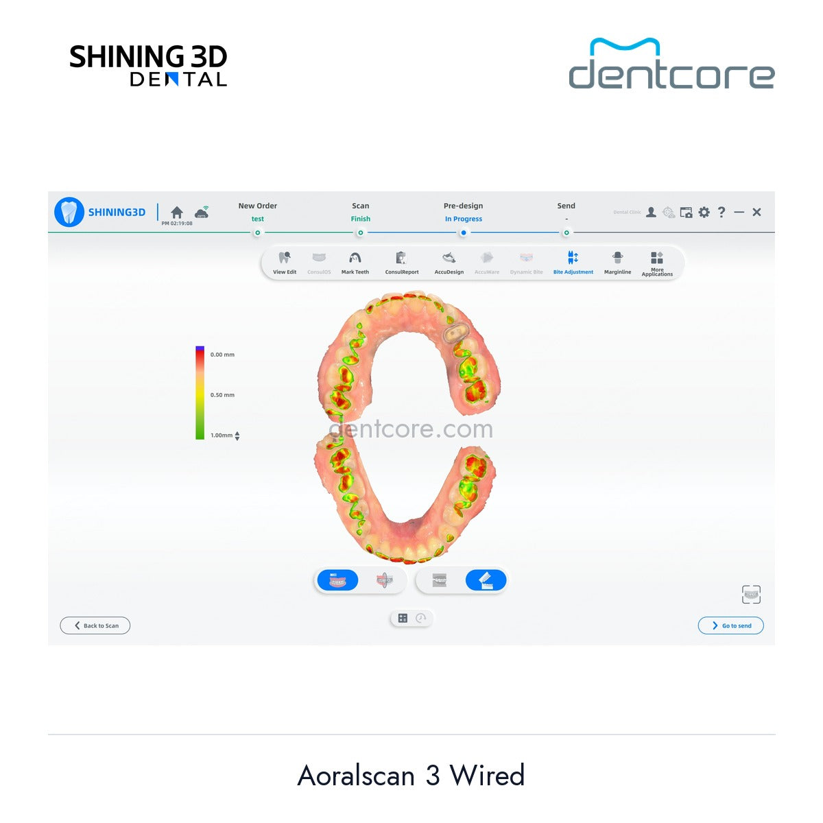 [DENTCORE-OFFICIAL] Aoralscan 3 Wired official product image 4
