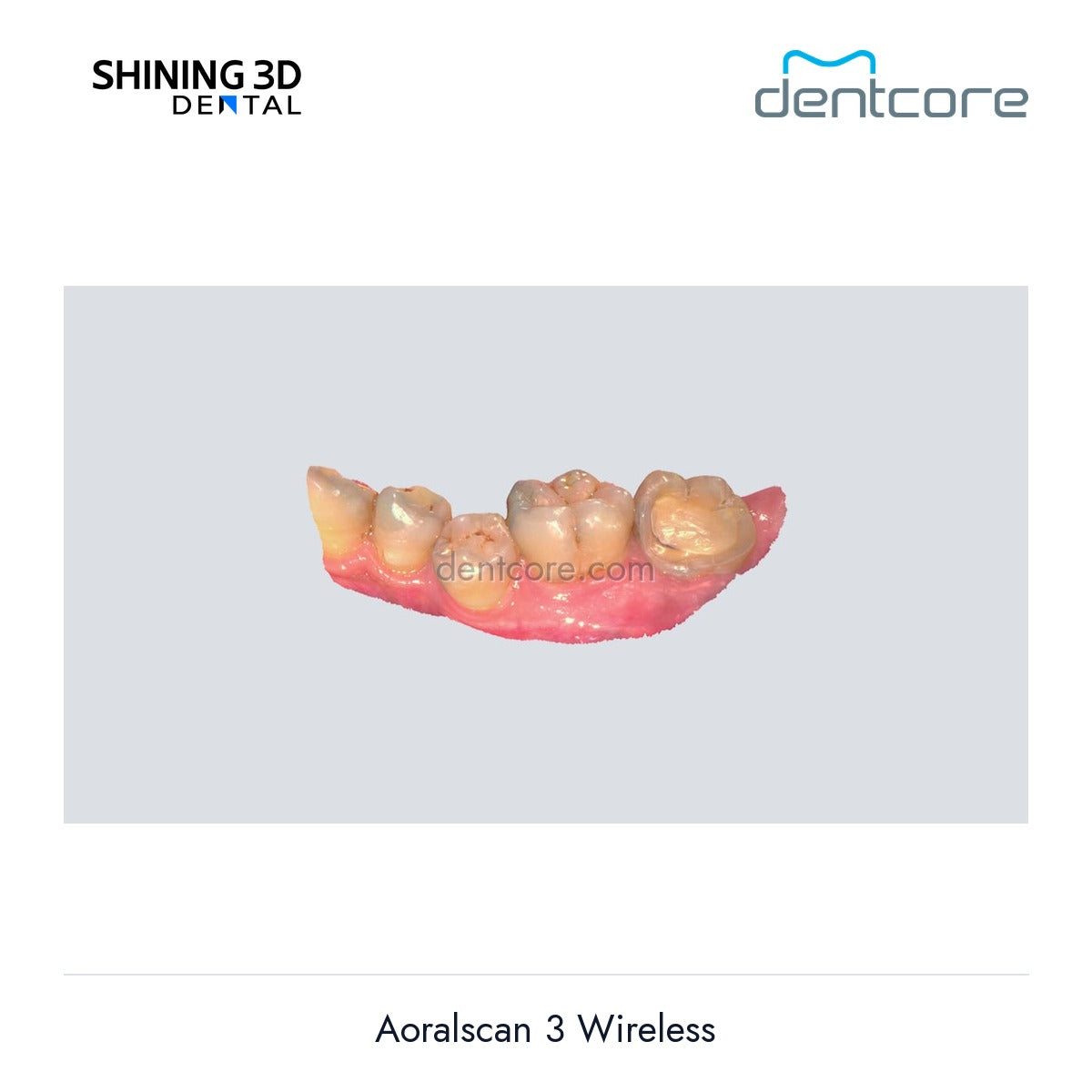 [DENTCORE-OFFICIAL] Aoralscan 3 Wireless official product image 4
