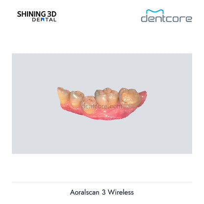 [DENTCORE-OFFICIAL] Aoralscan 3 Wireless official product image 4