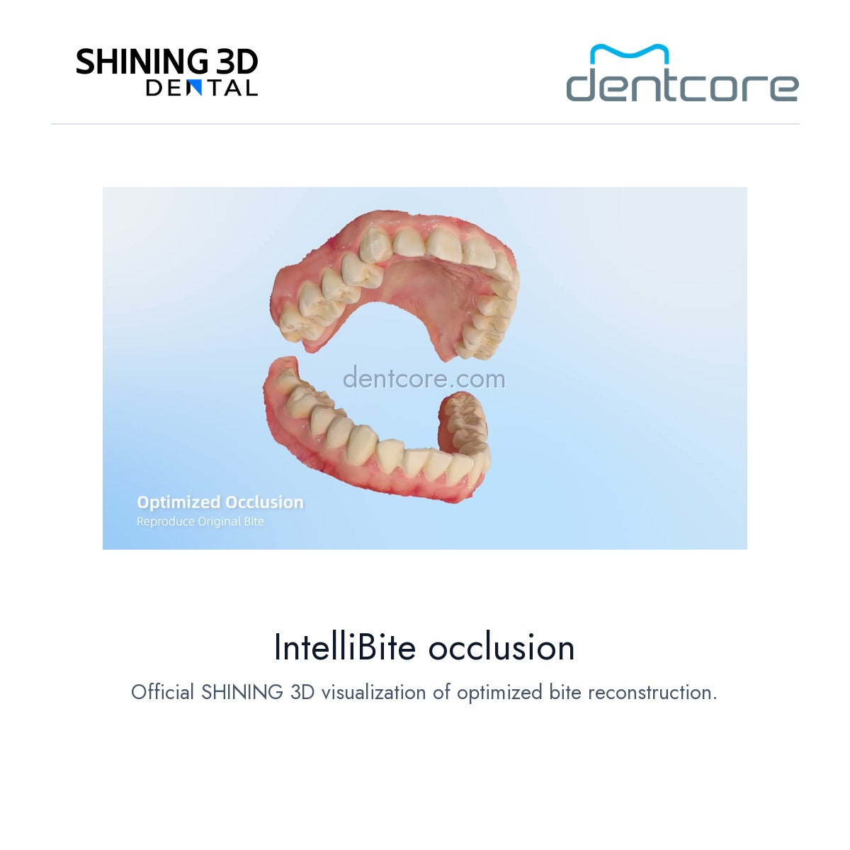 [DENTCORE-OFFICIAL] Aoralscan Elf — IntelliBite occlusion