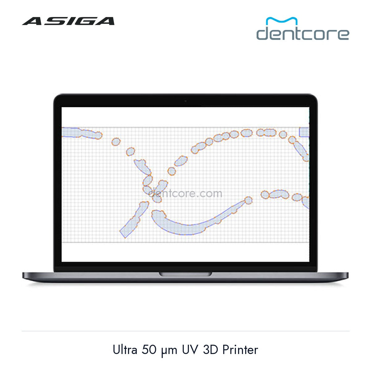 [DENTCORE-OFFICIAL] Asiga Ultra 50 µm UV 3D Printer official product image 4