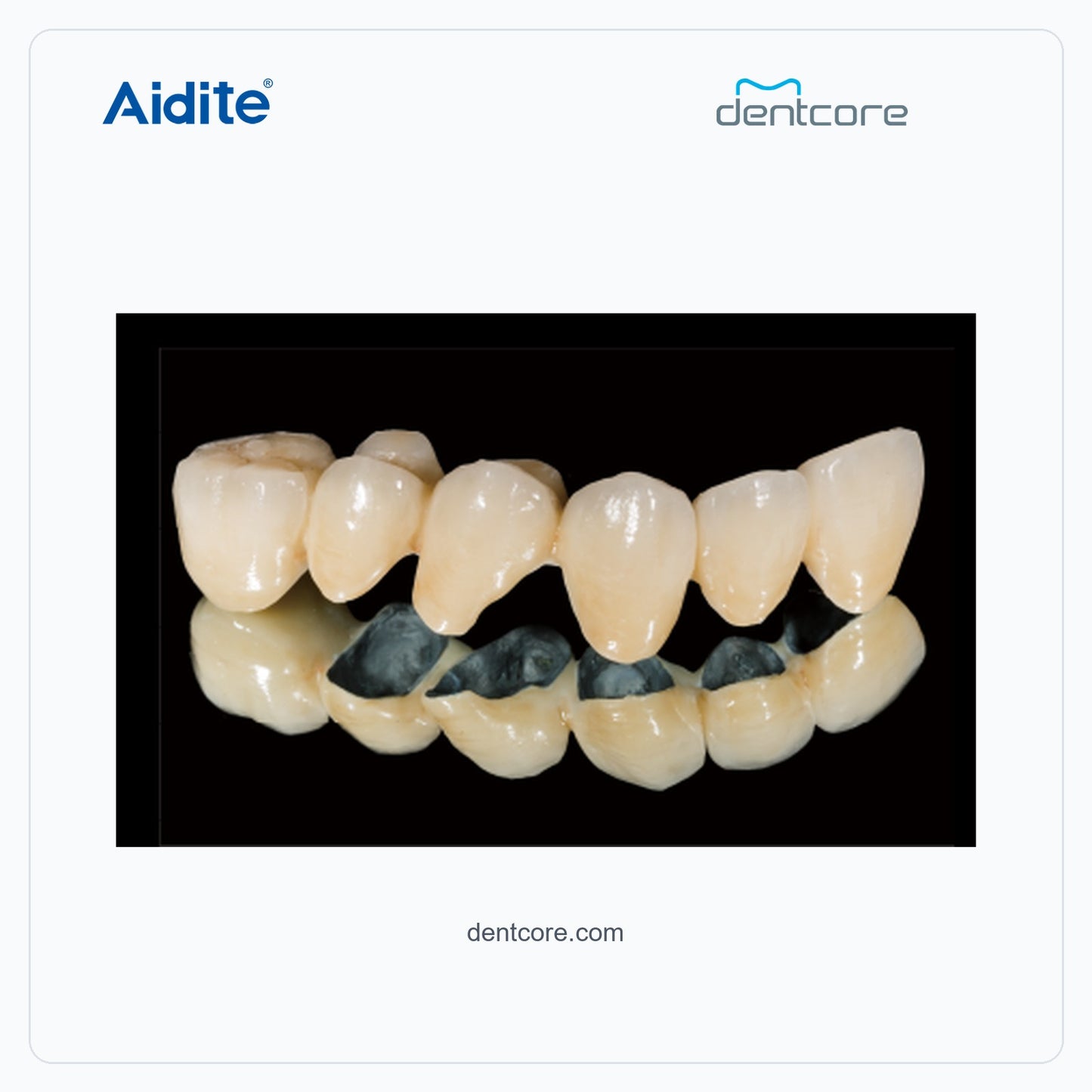 CFP-200 porcelain crown and veneer characterization