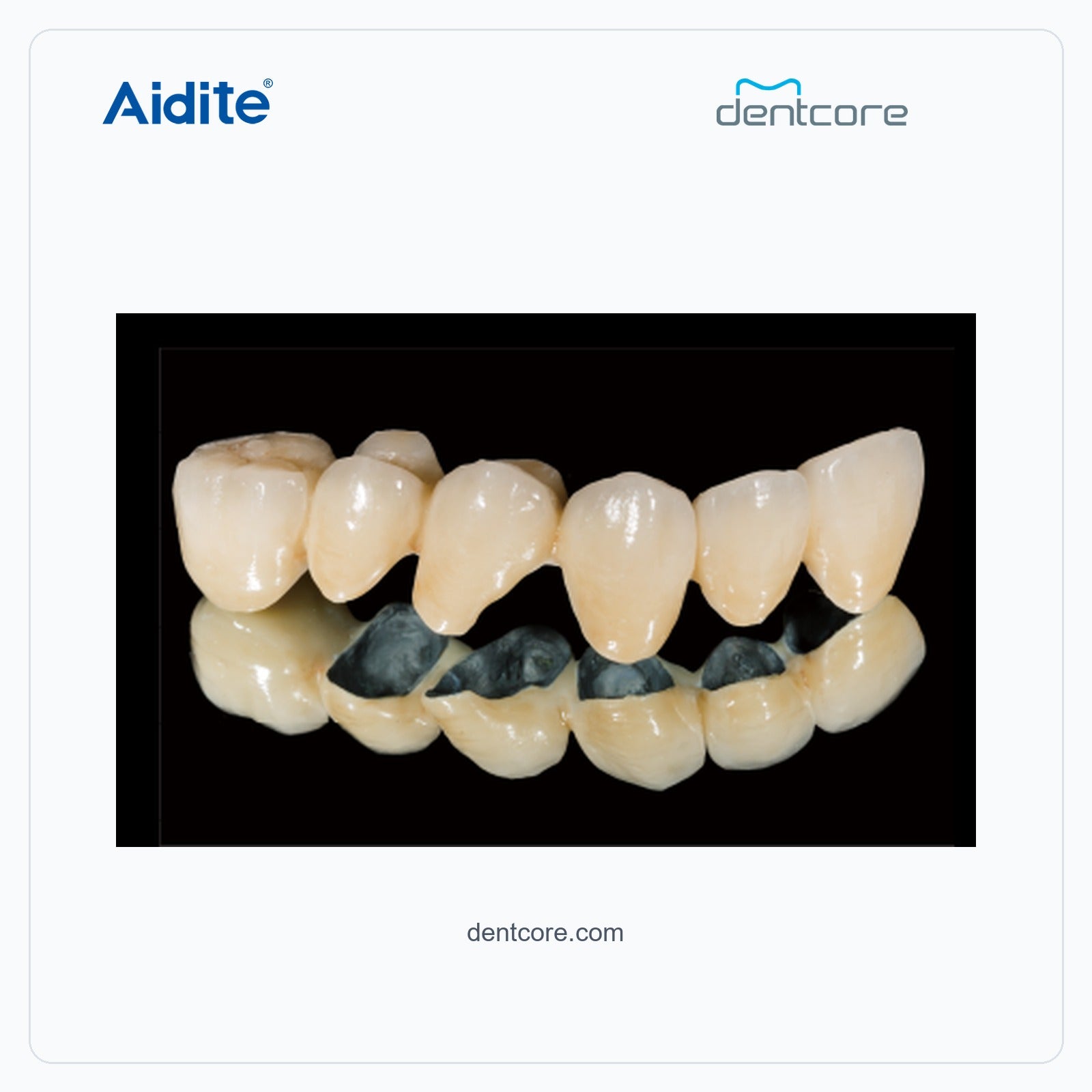 CFP-200 porcelain crown and veneer characterization