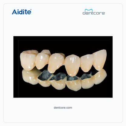 CFP-200 porcelain crown and veneer characterization