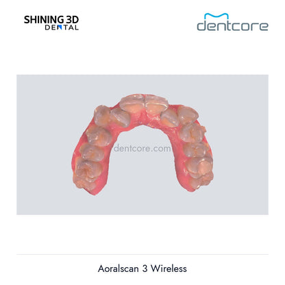 [DENTCORE-OFFICIAL] Aoralscan 3 Wireless official product image 5