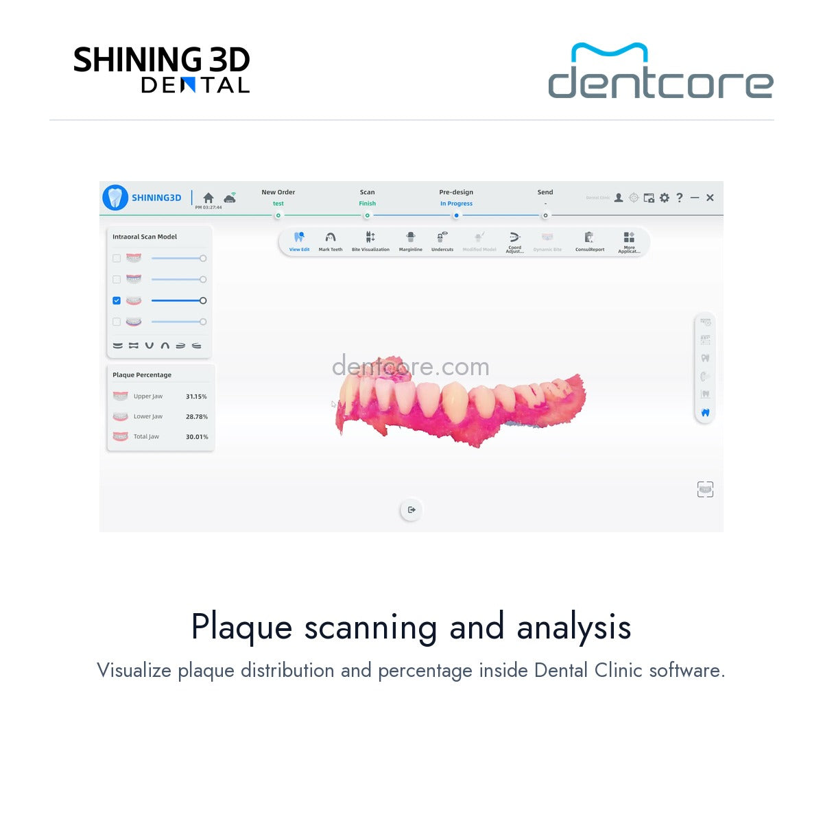 [DENTCORE-OFFICIAL] Aoralscan Elf — Plaque scanning and analysis