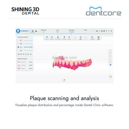 [DENTCORE-OFFICIAL] Aoralscan Elf — Plaque scanning and analysis
