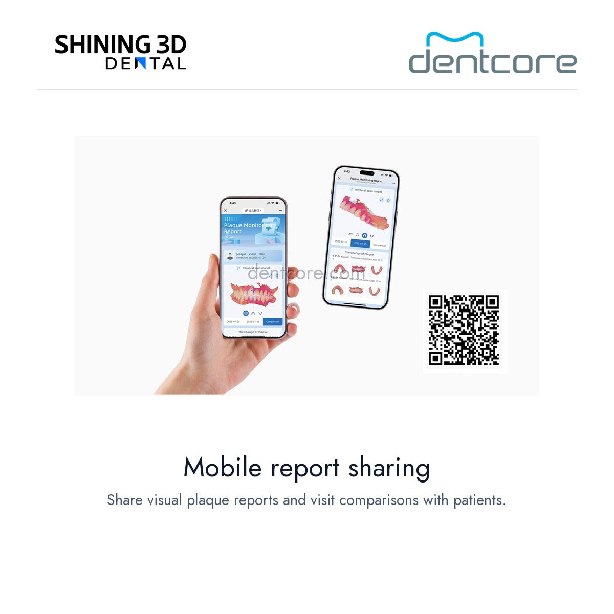[DENTCORE-OFFICIAL] Aoralscan Elf — Mobile report sharing