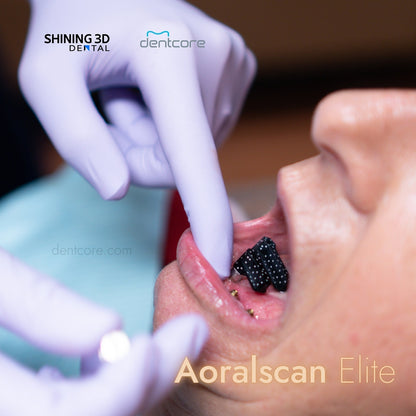 Shining 3D Aoralscan Elite IOS + IPG - Dentcore
