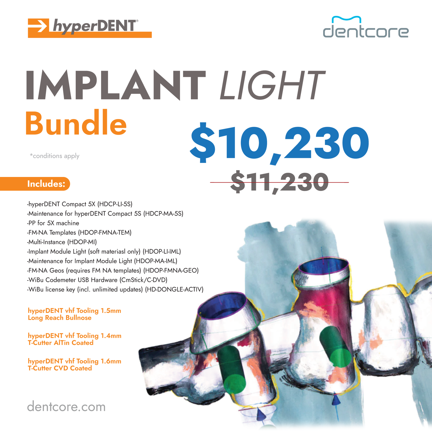 hyperdent Implant Light Bundle