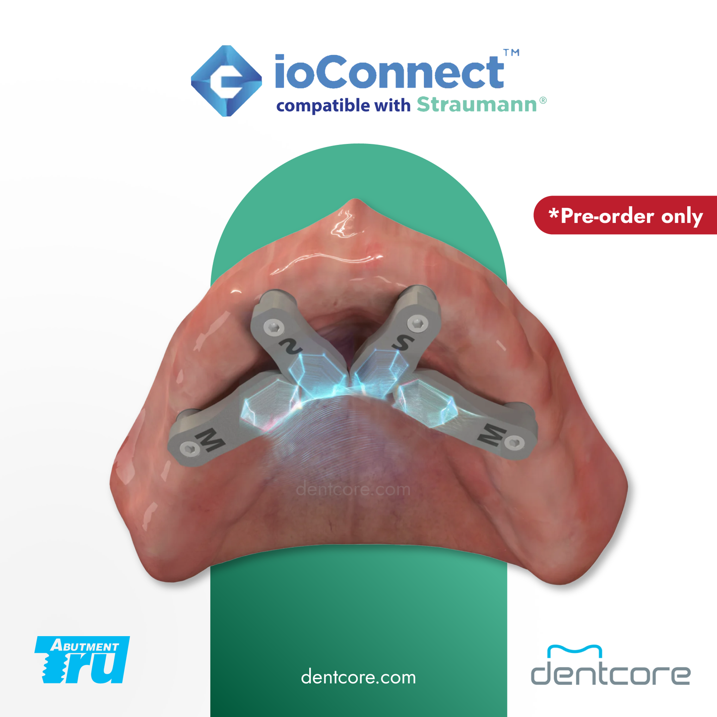 TruAbutment ioConnect Straumann MUA Compatible Scanbody*