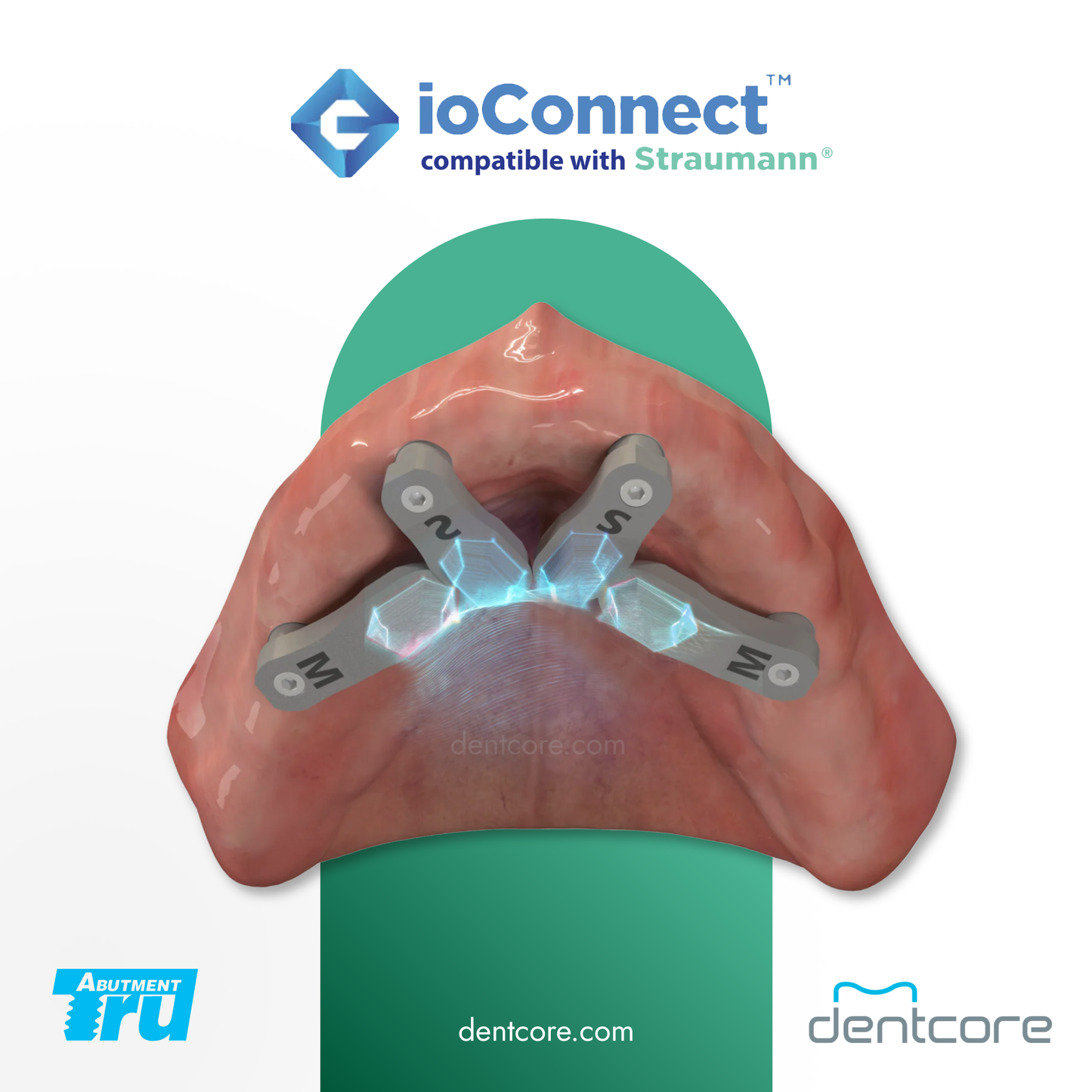 TruAbutment ioConnect Straumann MUA Compatible Scanbody