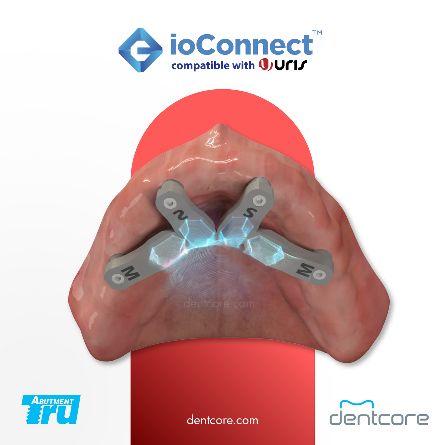 TruAbutment ioConnect URIS MUA Compatible Scanbody