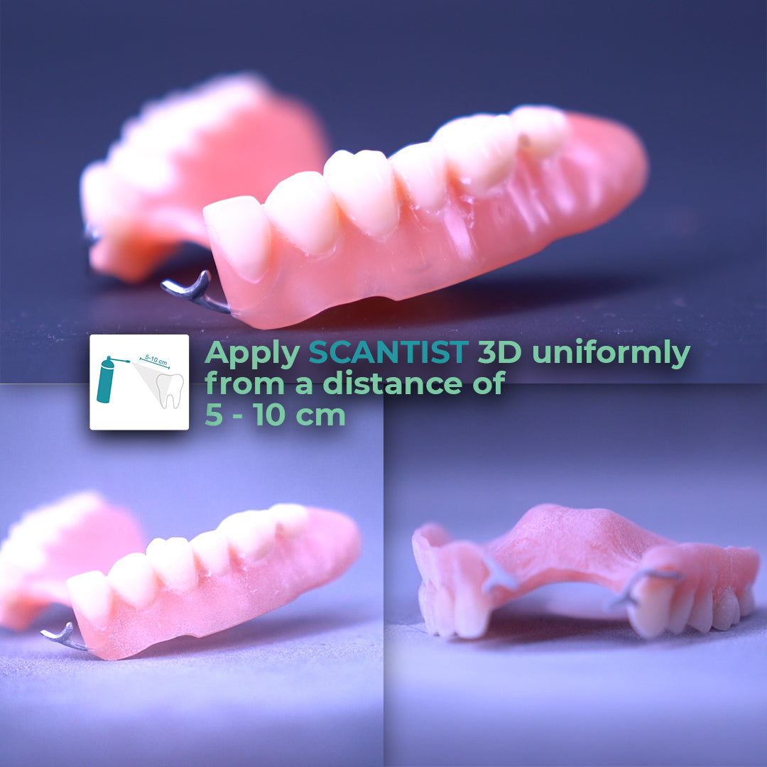 Scantist 3D vanishing dentures