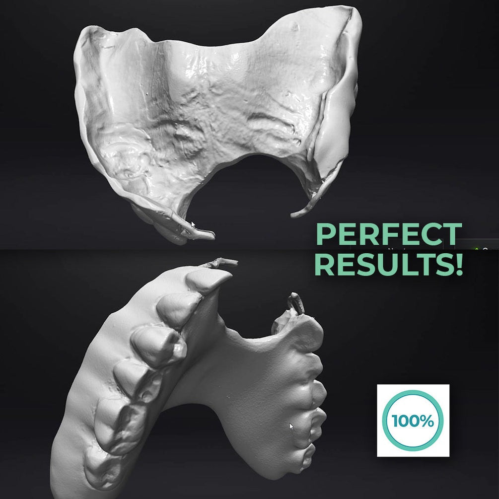 Scantist 3D Vanishing Spray - Dentcore