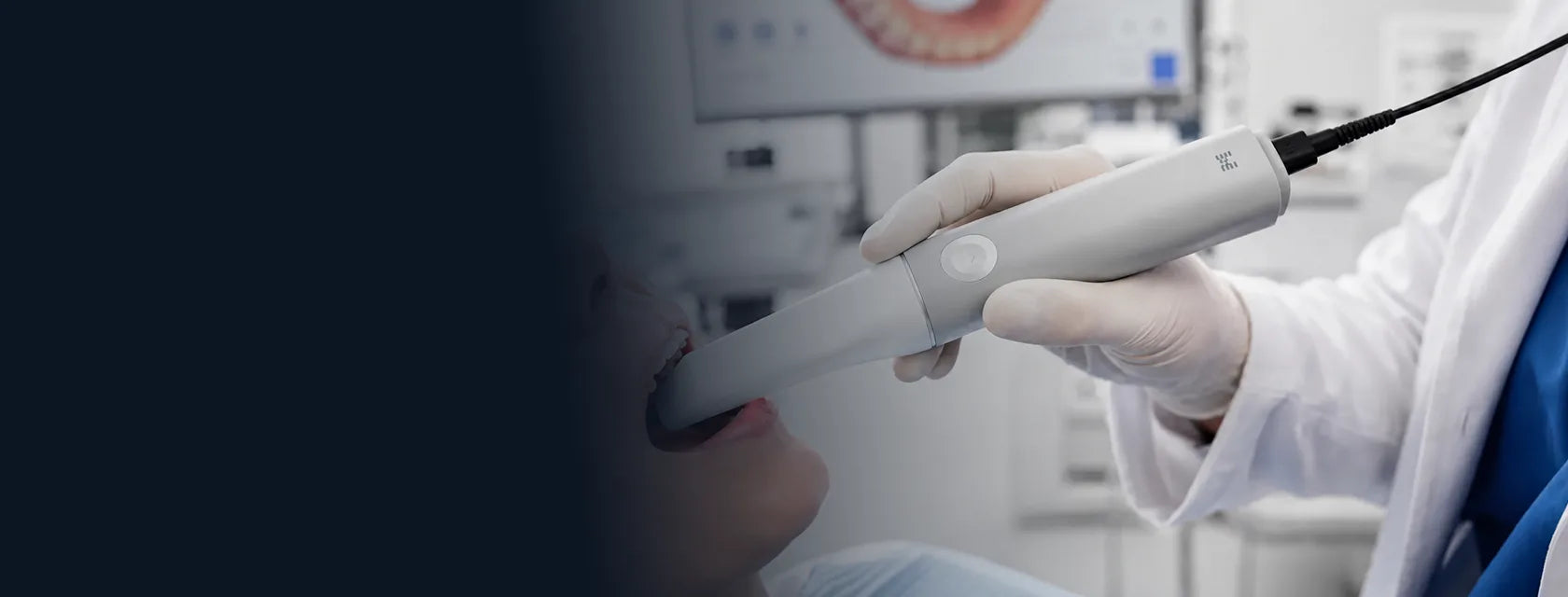 Medit iE scanning with the connected handpiece
