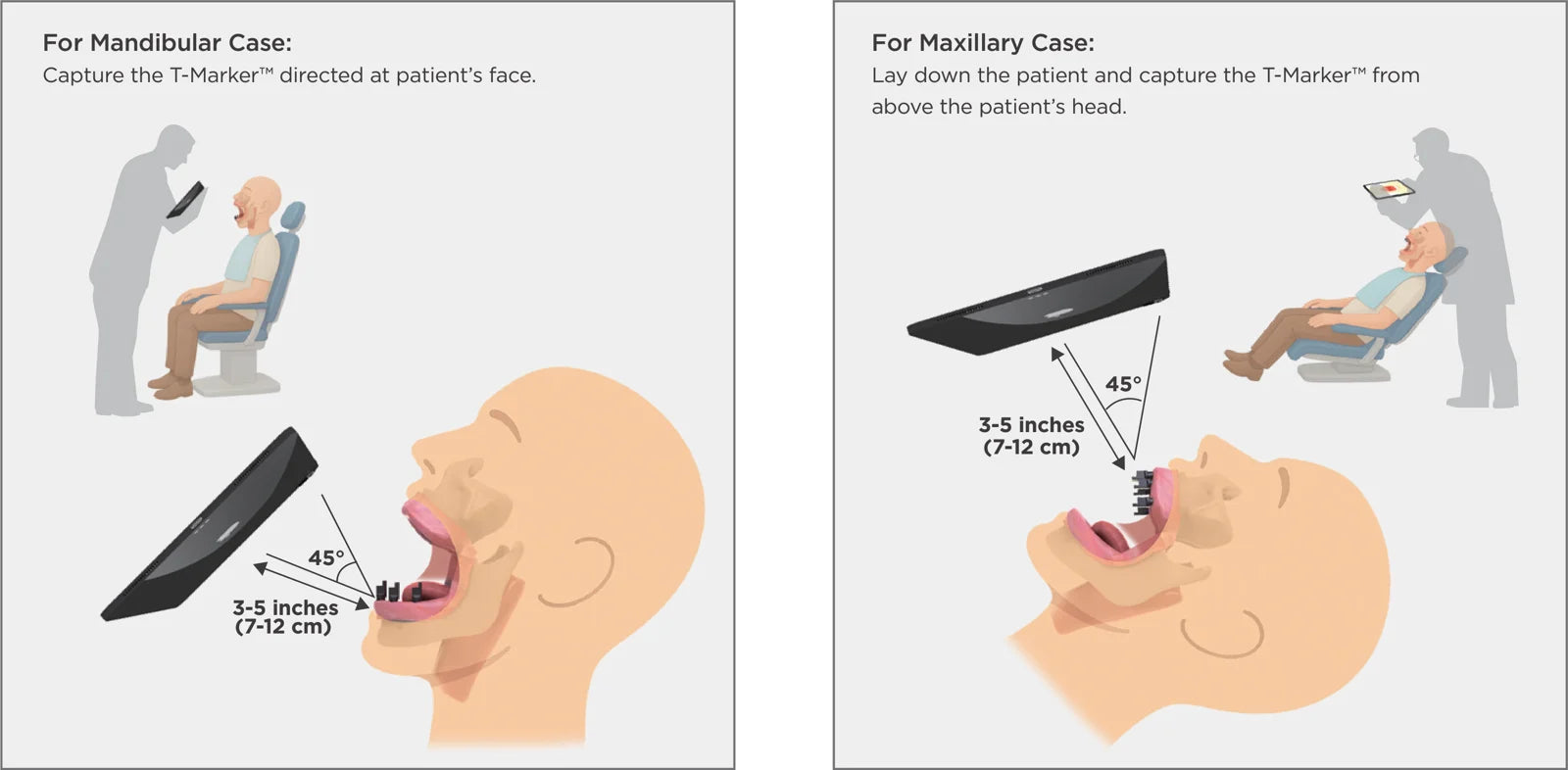 Capture positions for lower and upper arch cases